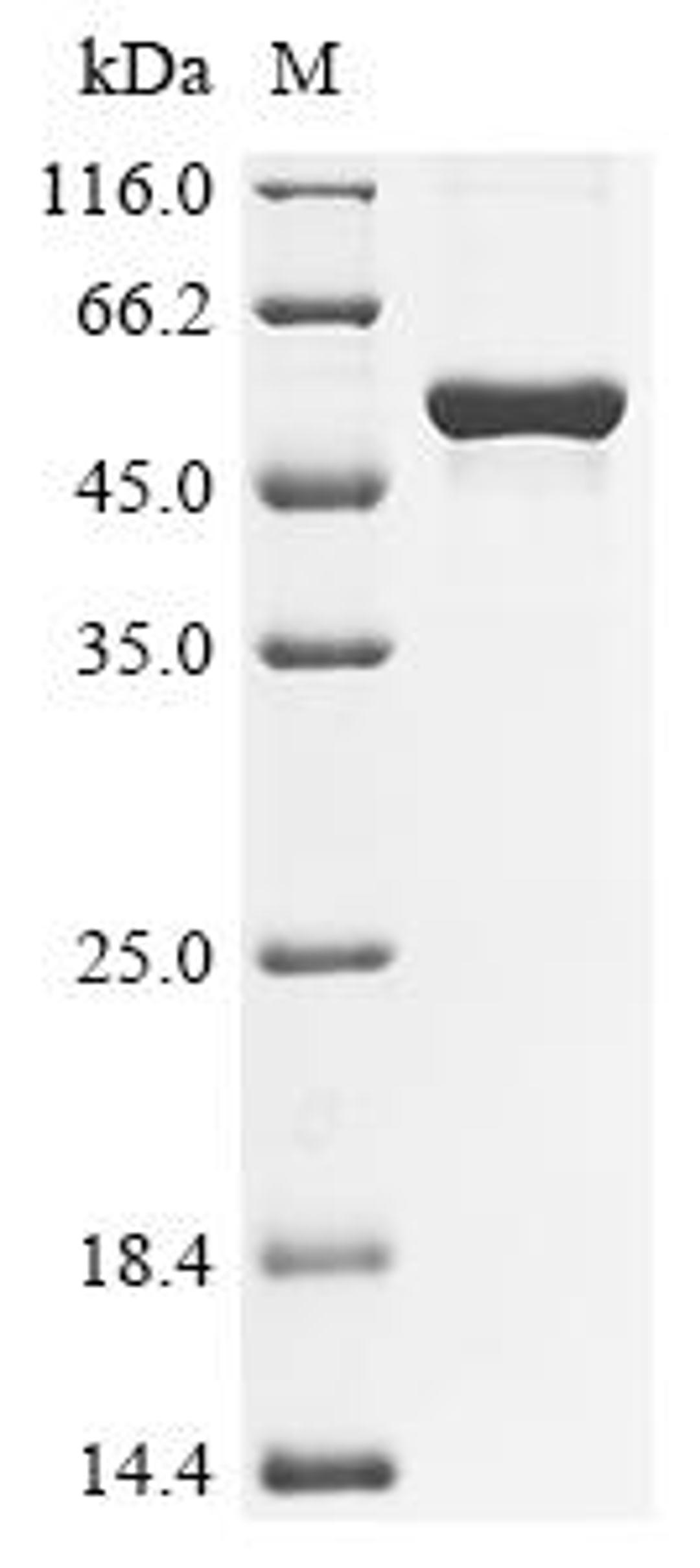 (Tris-Glycine gel) Discontinuous SDS-PAGE (reduced) with 5% enrichment gel and 15% separation gel.