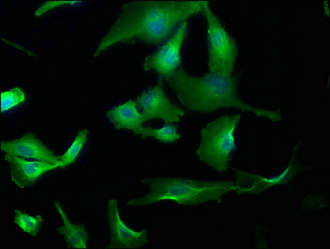 Immunofluorescence staining of U251 cells with CSB-PA764810LA01HU at 1:173, counter-stained with DAPI. The cells were fixed in 4% formaldehyde, permeabilized using 0.2% Triton X-100 and blocked in 10% normal Goat Serum. The cells were then incubated with the antibody overnight at 4°C. The secondary antibody was Alexa Fluor 488-congugated AffiniPure Goat Anti-Rabbit IgG(H+L).