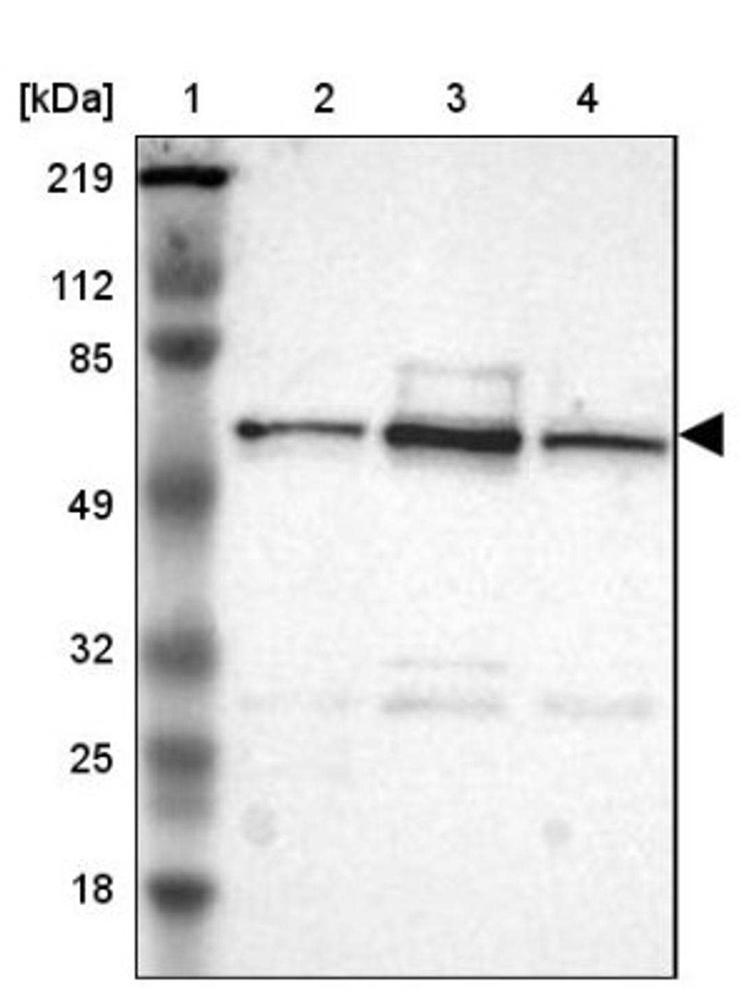 Western Blot: UPF3B Antibody [NBP1-83135] - Lane 1: Marker [kDa] 219, 112, 85, 49, 32, 25, 18<br/>Lane 2: Human cell line RT-4<br/>Lane 3: Human cell line U-251MG sp<br/>Lane 4: Human cell line A-431