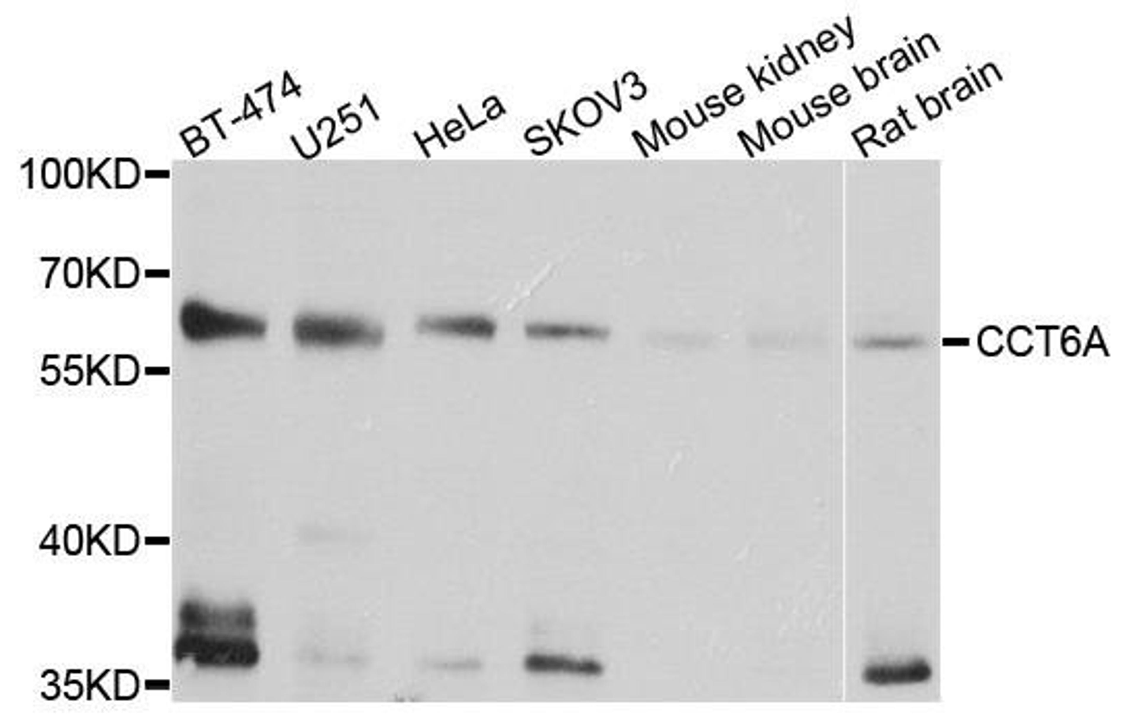 Western blot analysis of extract of various cells using CCT6A antibody