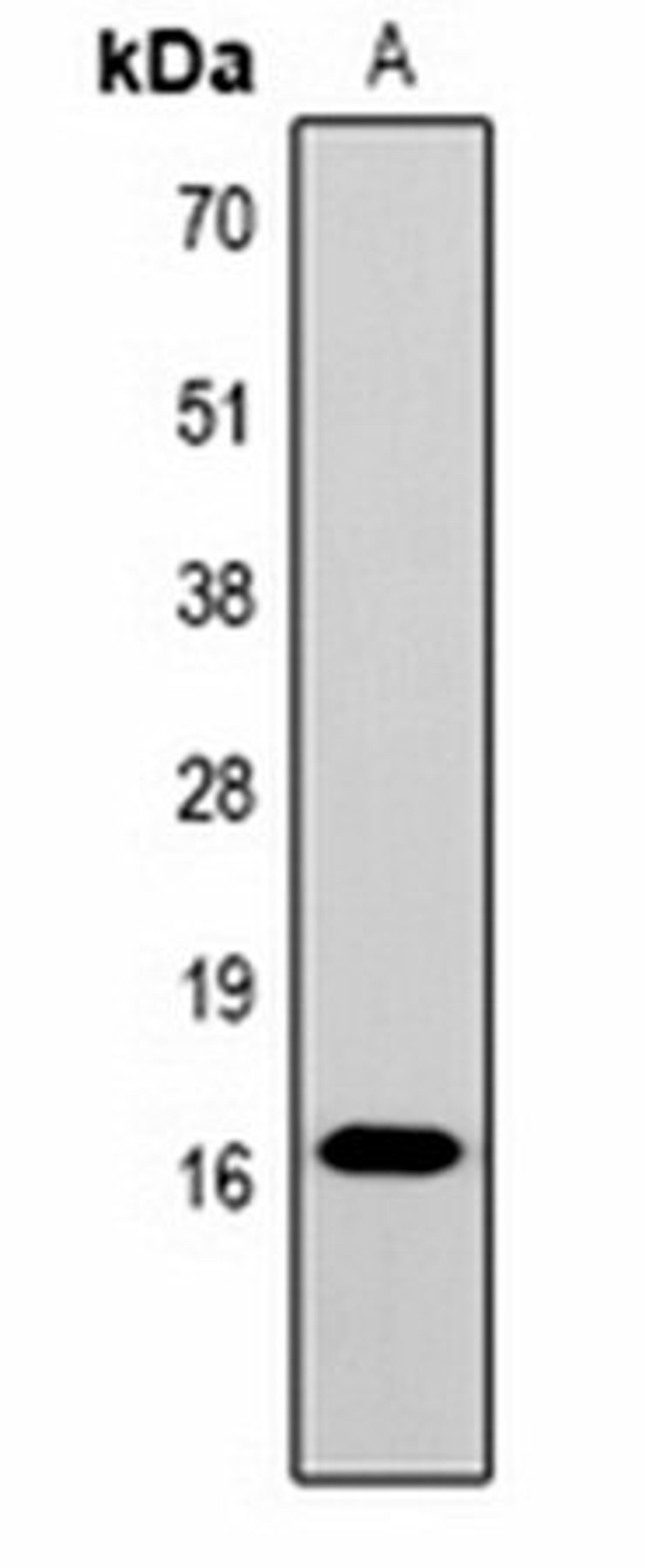 Western blot analysis of  Hela (Lane1) whole cell lysates using Histone H1 (TriMethyl K25) antibody