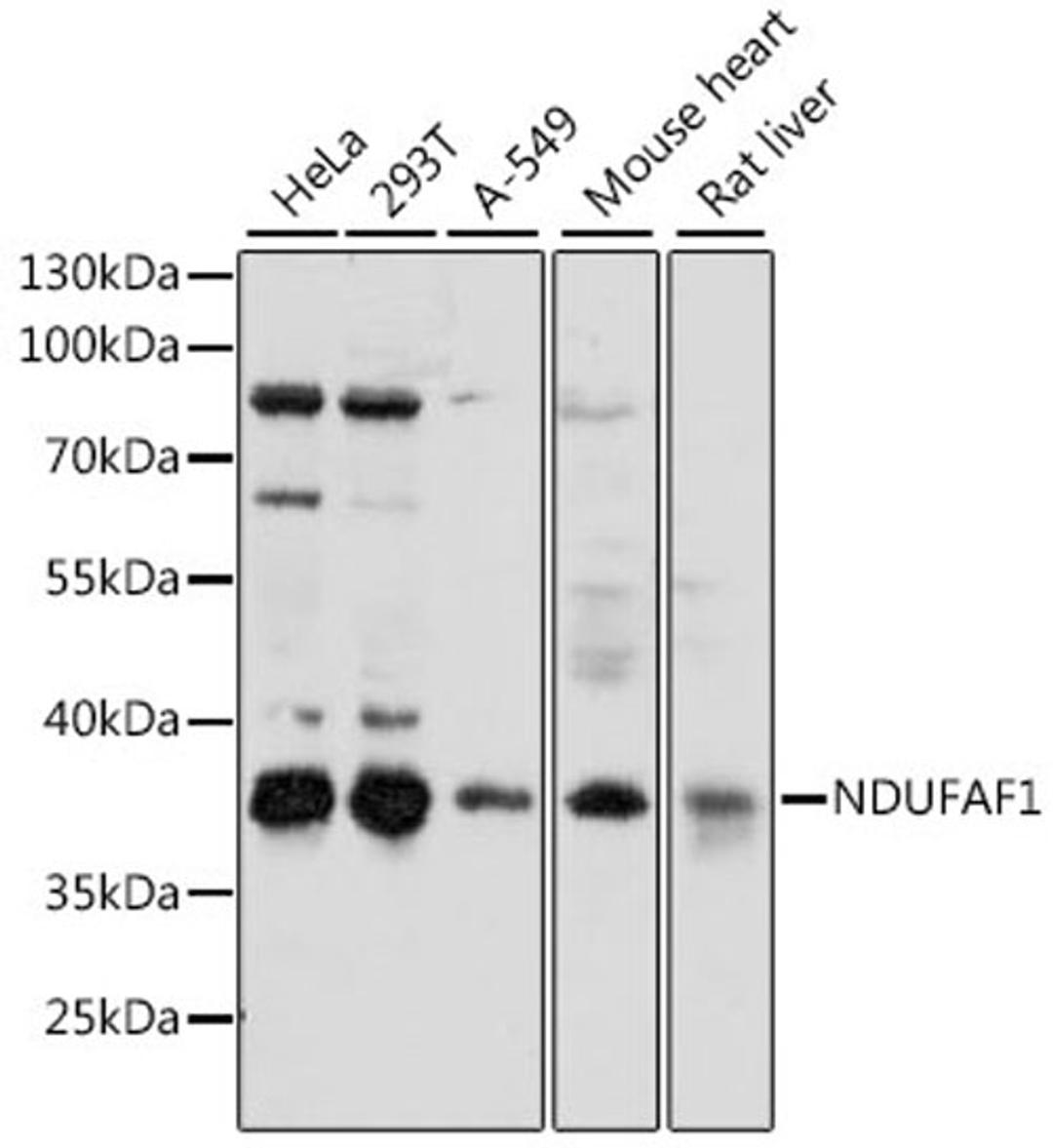 Western blot - NDUFAF1 antibody (A15835)