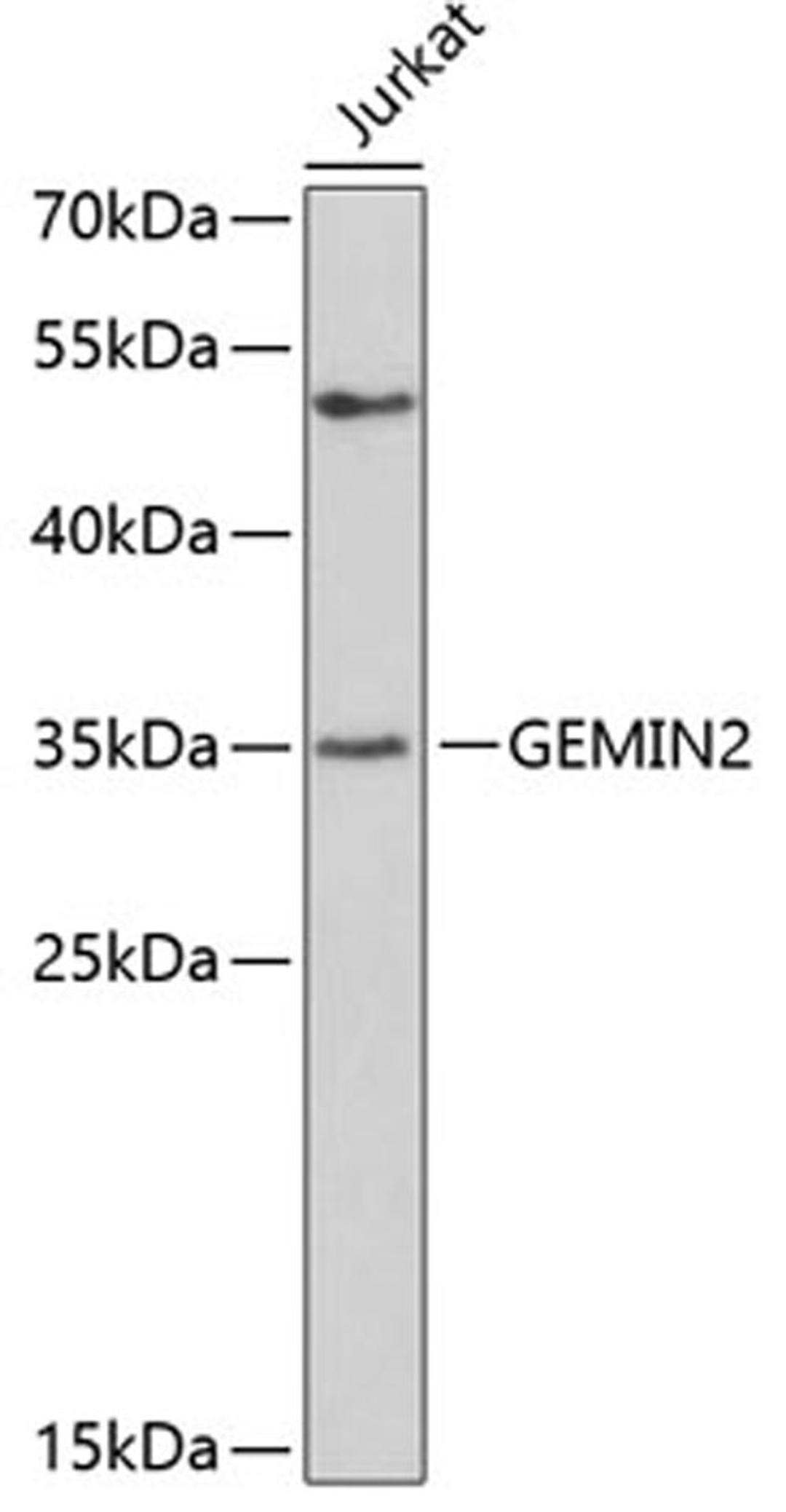 Western blot - GEMIN2 antibody (A3082)
