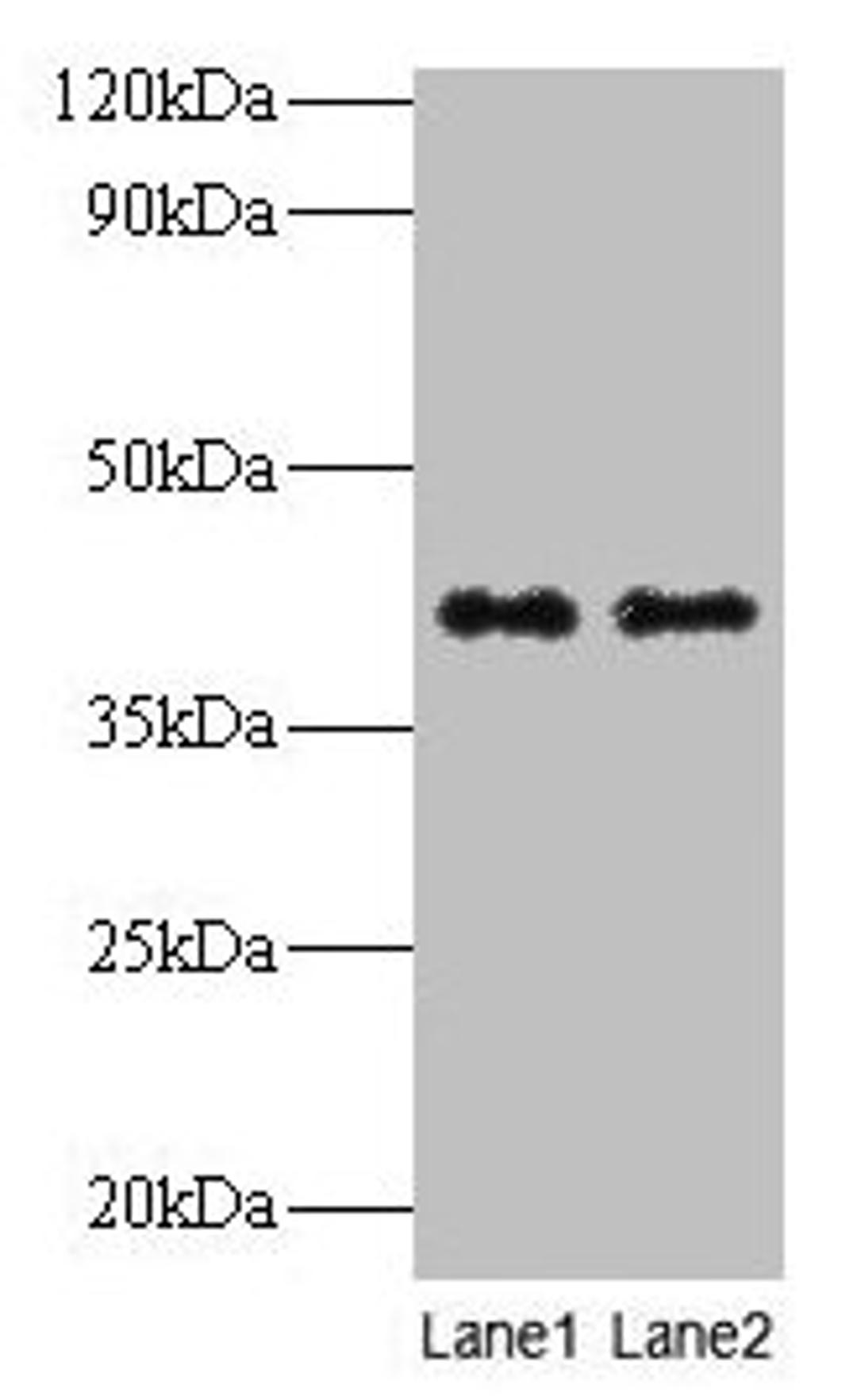 Western blot. All lanes: QPCT antibody at 2µg/ml. Lane 1: Rat muscle tissue. Lane 2: Rat adrenal gland tissue. Secondary. Goat polyclonal to rabbit IgG at 1/10000 dilution. Predicted band size: 41, 36 kDa. Observed band size: 41 kDa