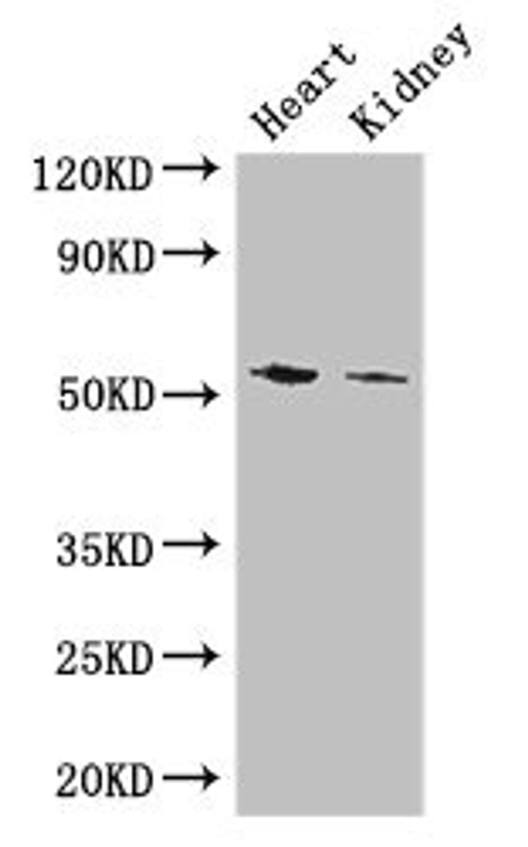Western Blot. Positive WB detected in: Mouse heart tissue, Mouse kidney tissue. All lanes: CYP11B1 antibody at 3ug/ml. Secondary. Goat polyclonal to rabbit IgG at 1/50000 dilution. Predicted band size: 58, 50 kDa. Observed band size: 58 kDa.