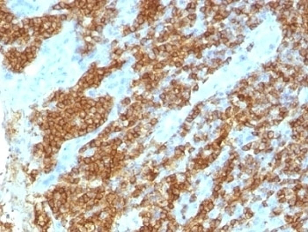 IHC test of FFPE human tonsil probed with CD45RA antibody