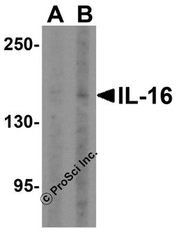 Western blot analysis of IL-16 in rat brain tissue lysate with IL-16 antibody at (A) 2.5 and (B) 5 μg/mL.