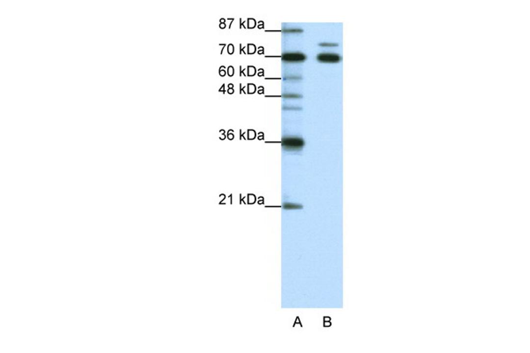 Antibody used in WB on Human HepG2 at 1.25 ug/ml.