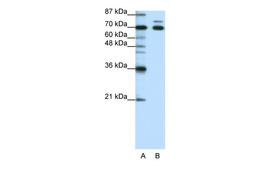 Antibody used in WB on Human HepG2 at 1.25 ug/ml.