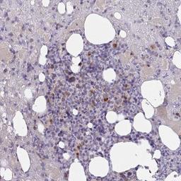 Immunohistochemistry-Paraffin: MIA3 Antibody [NBP2-33770] - Immunohistochemical staining of human bone marrow shows strong cytoplasmic positivity in subset of hematopoietic cells.