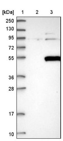 Western Blot: PIP5K2 gamma Antibody [NBP1-92272] - Lane 1: Marker [kDa] 250, 130, 95, 72, 55, 36, 28, 17, 10<br/>Lane 2: Negative control (vector only transfected HEK293T lysate)<br/>Lane 3: Over-expression lysate (Co-expressed with a C-terminal myc-DDK tag (~3.1 kDa) in mammalian HEK293T cells, LY411069)