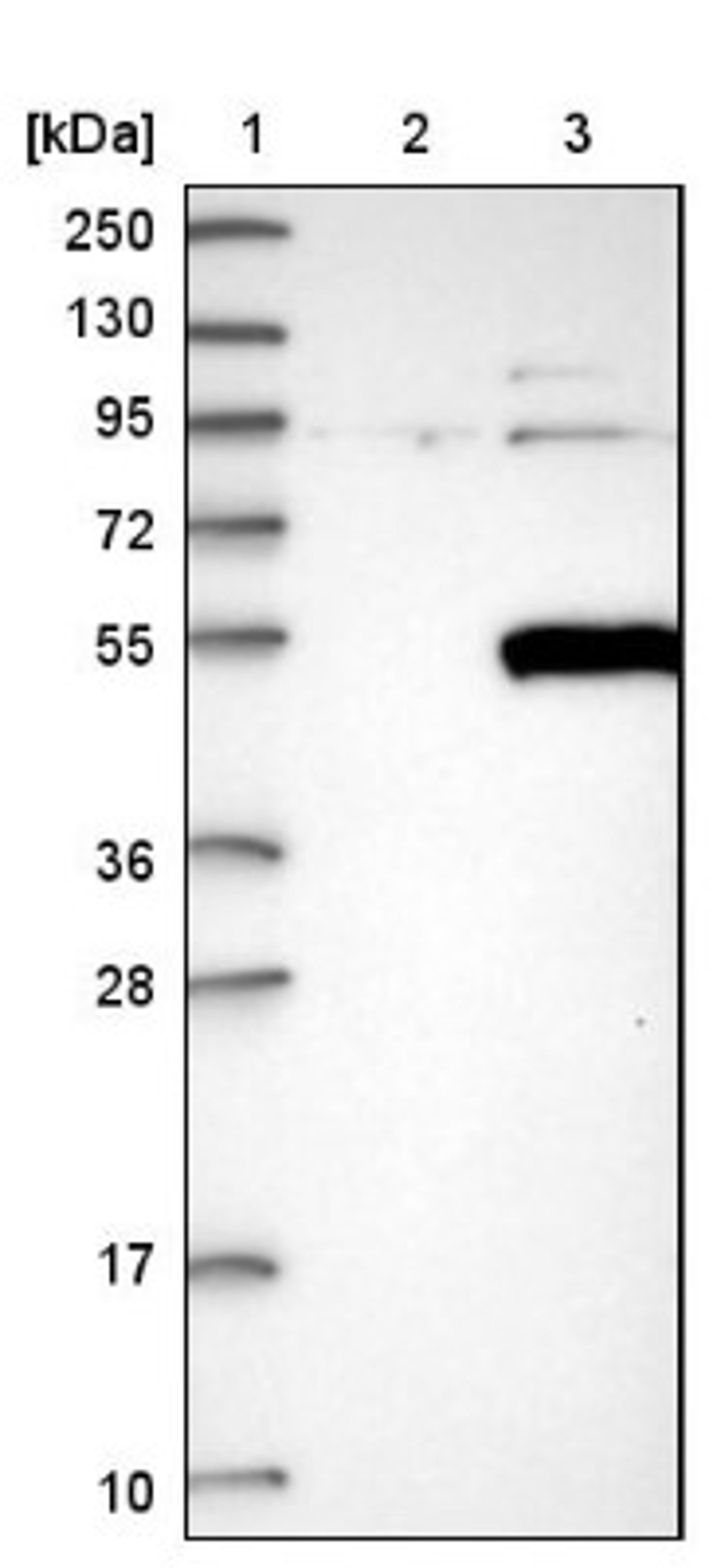 Western Blot: PIP5K2 gamma Antibody [NBP1-92272] - Lane 1: Marker [kDa] 250, 130, 95, 72, 55, 36, 28, 17, 10<br/>Lane 2: Negative control (vector only transfected HEK293T lysate)<br/>Lane 3: Over-expression lysate (Co-expressed with a C-terminal myc-DDK tag (~3.1 kDa) in mammalian HEK293T cells, LY411069)