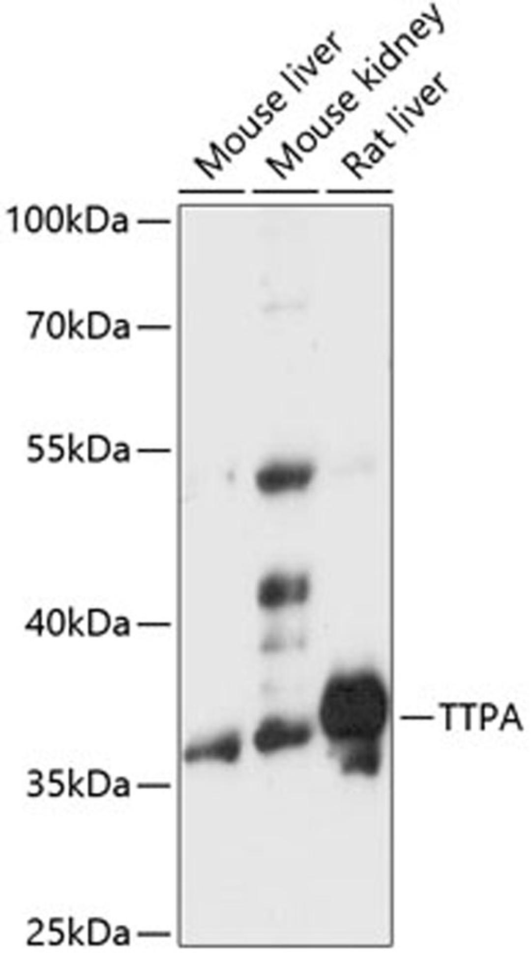 Western blot - TTPA antibody (A14473)