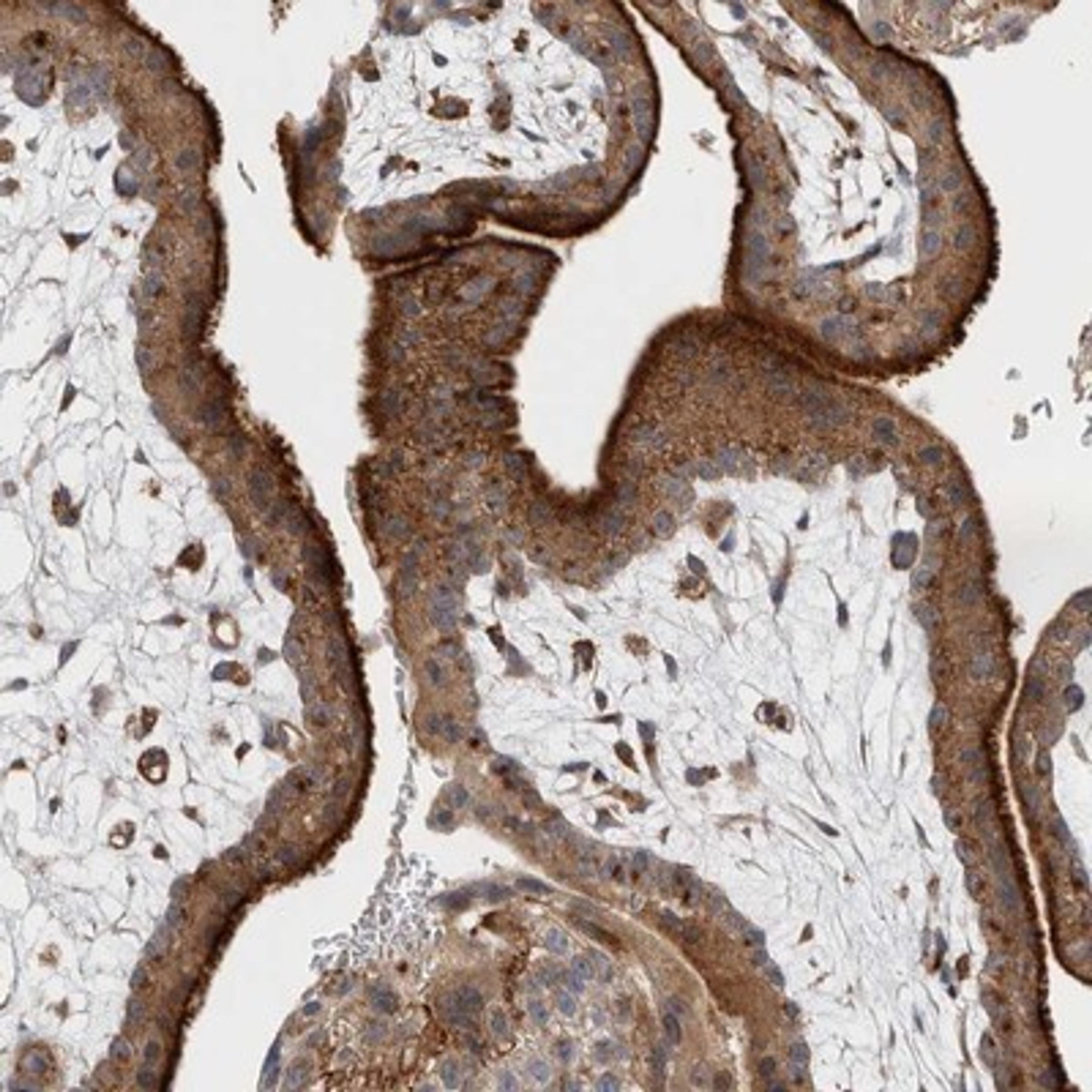 Immunohistochemistry-Paraffin: BNIP2 Antibody [NBP1-88559] - Immunohistochemical staining of human placenta shows strong cytoplasmic positivity in trophoblastic cells.