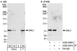 Detection of human GNL1 by western blot and immunoprecipitation.