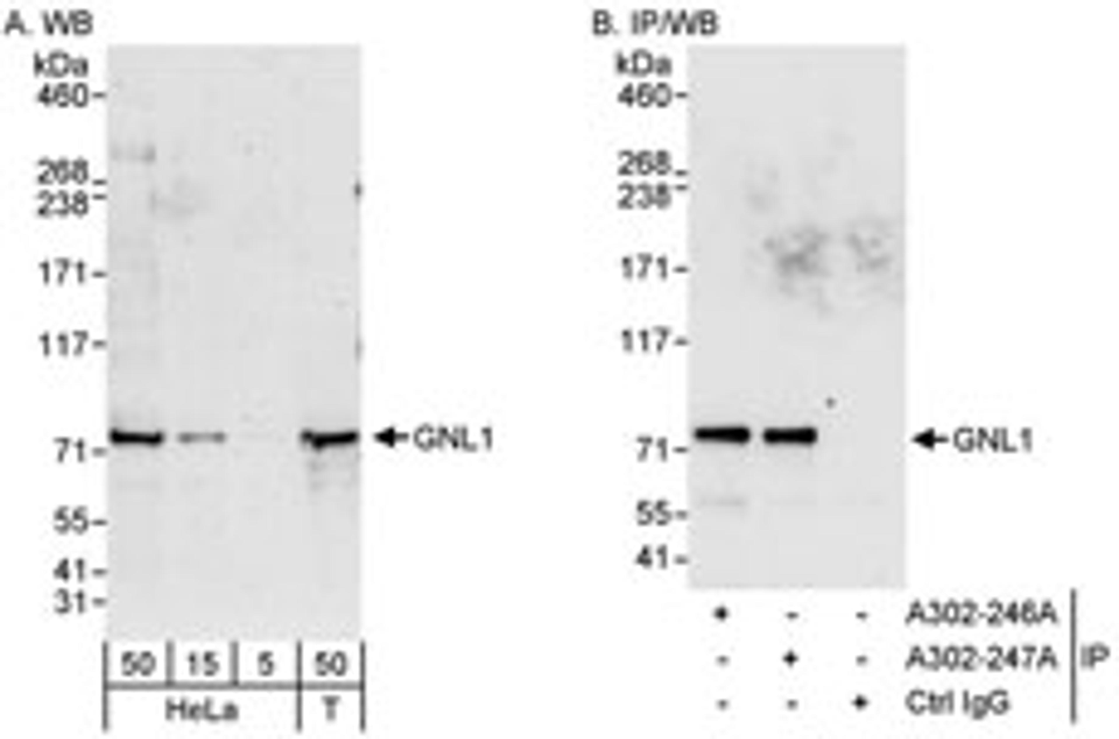 Detection of human GNL1 by western blot and immunoprecipitation.