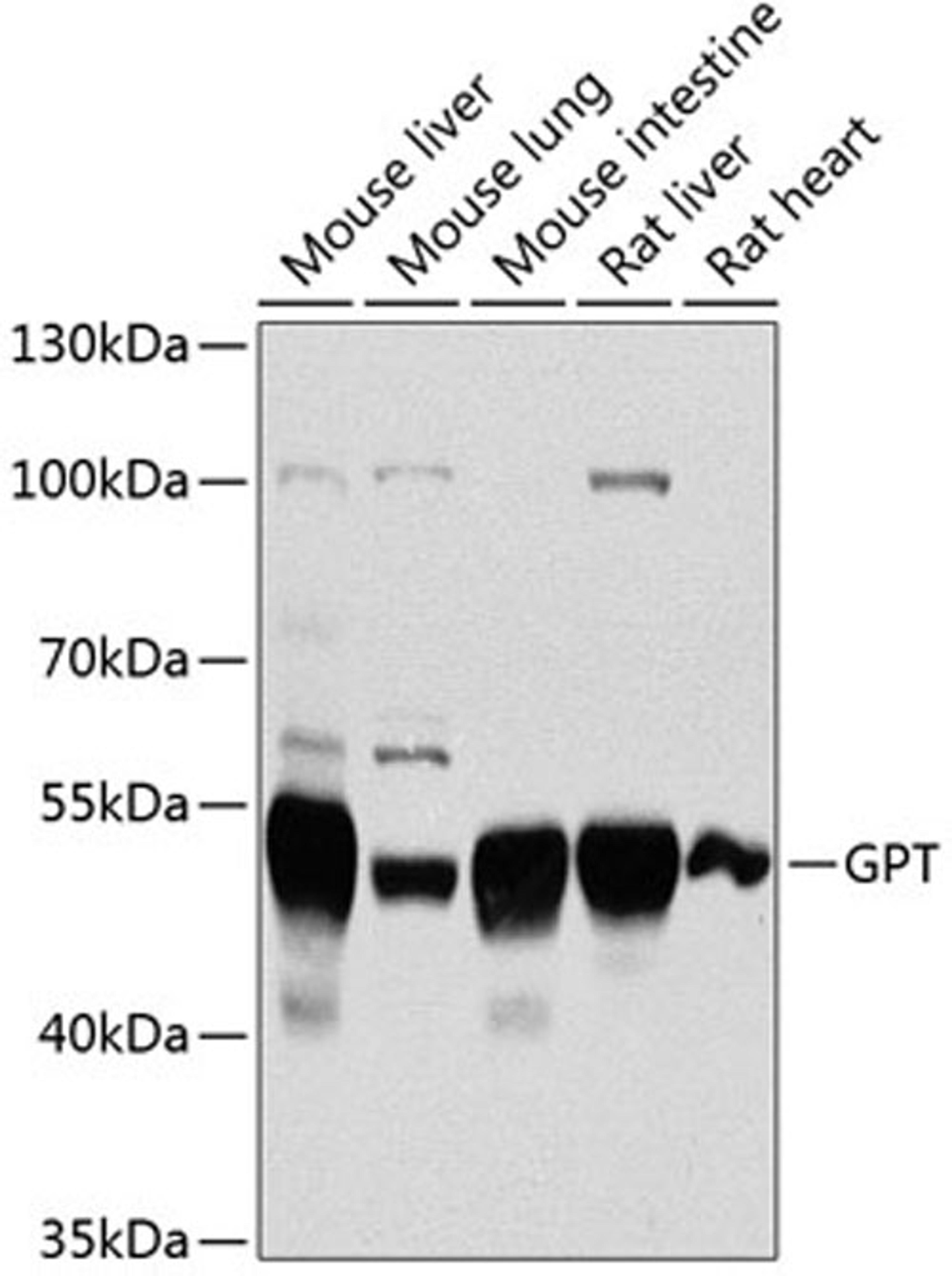 Western blot - GPT antibody (A2814)