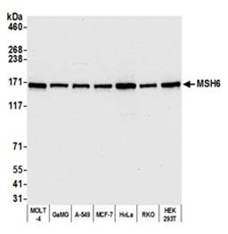 Detection of human MSH6 by western blot.