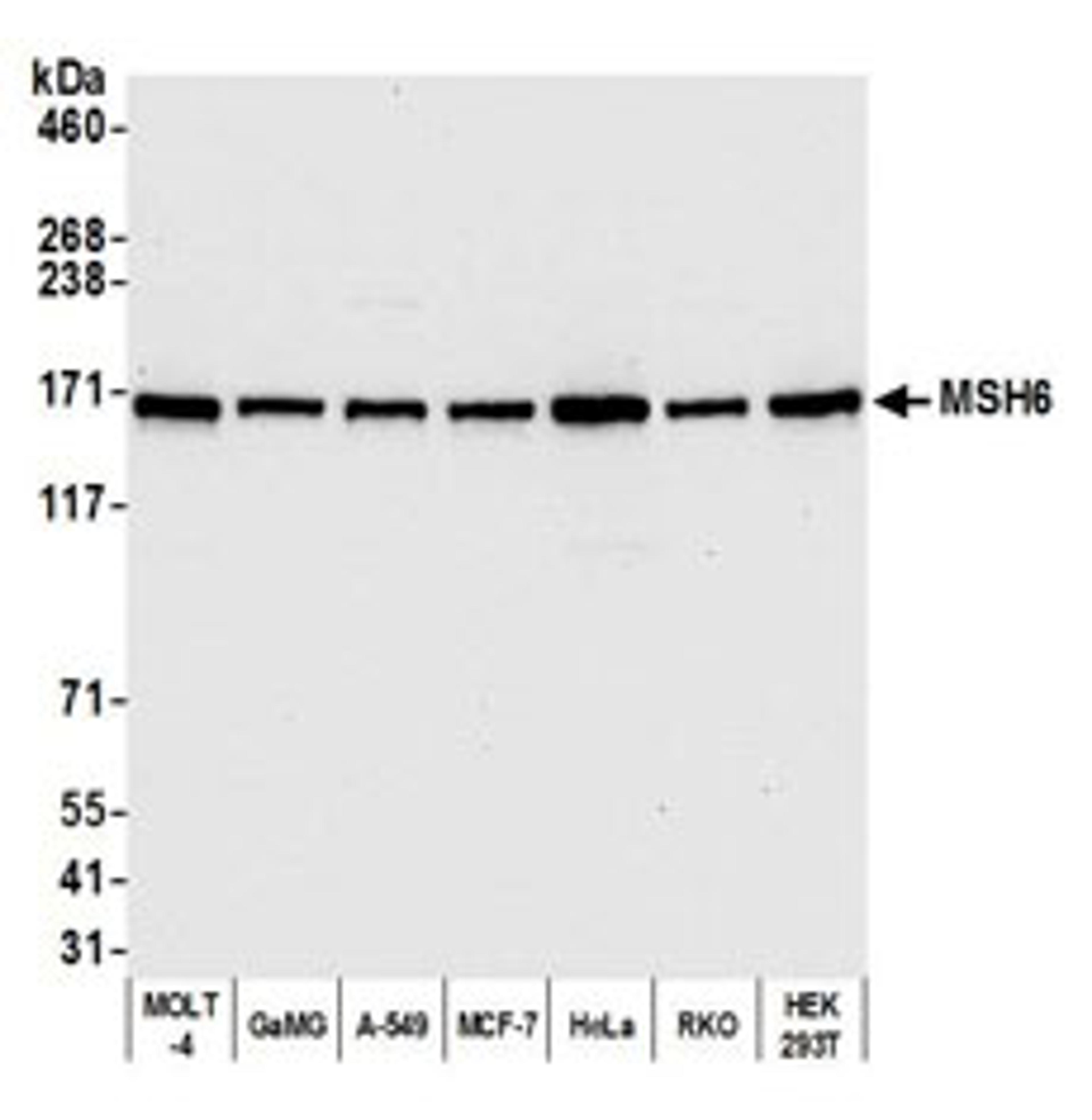 Detection of human MSH6 by western blot.