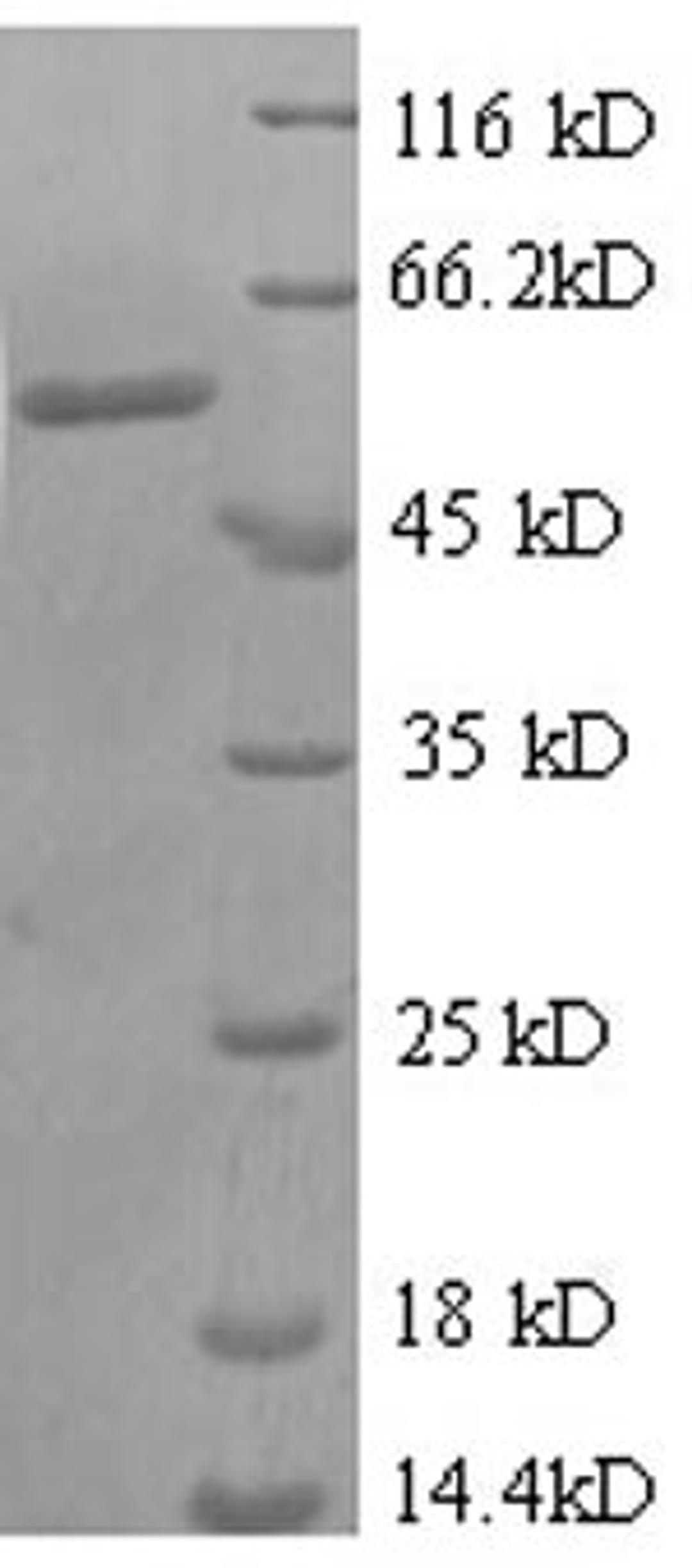 (Tris-Glycine gel) Discontinuous SDS-PAGE (reduced) with 5% enrichment gel and 15% separation gel.