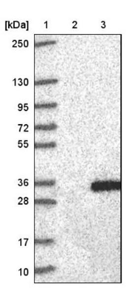 Western Blot: CRISP2 Antibody [NBP1-85452] - Lane 1: Marker [kDa] 250, 130, 95, 72, 55, 36, 28, 17, 10<br/>Lane 2: Negative control (vector only transfected HEK293T lysate)<br/>Lane 3: Over-expression lysate (Co-expressed with a C-terminal myc-DDK tag (~3.1 kDa) in mammalian HEK293T cells, LY418782)