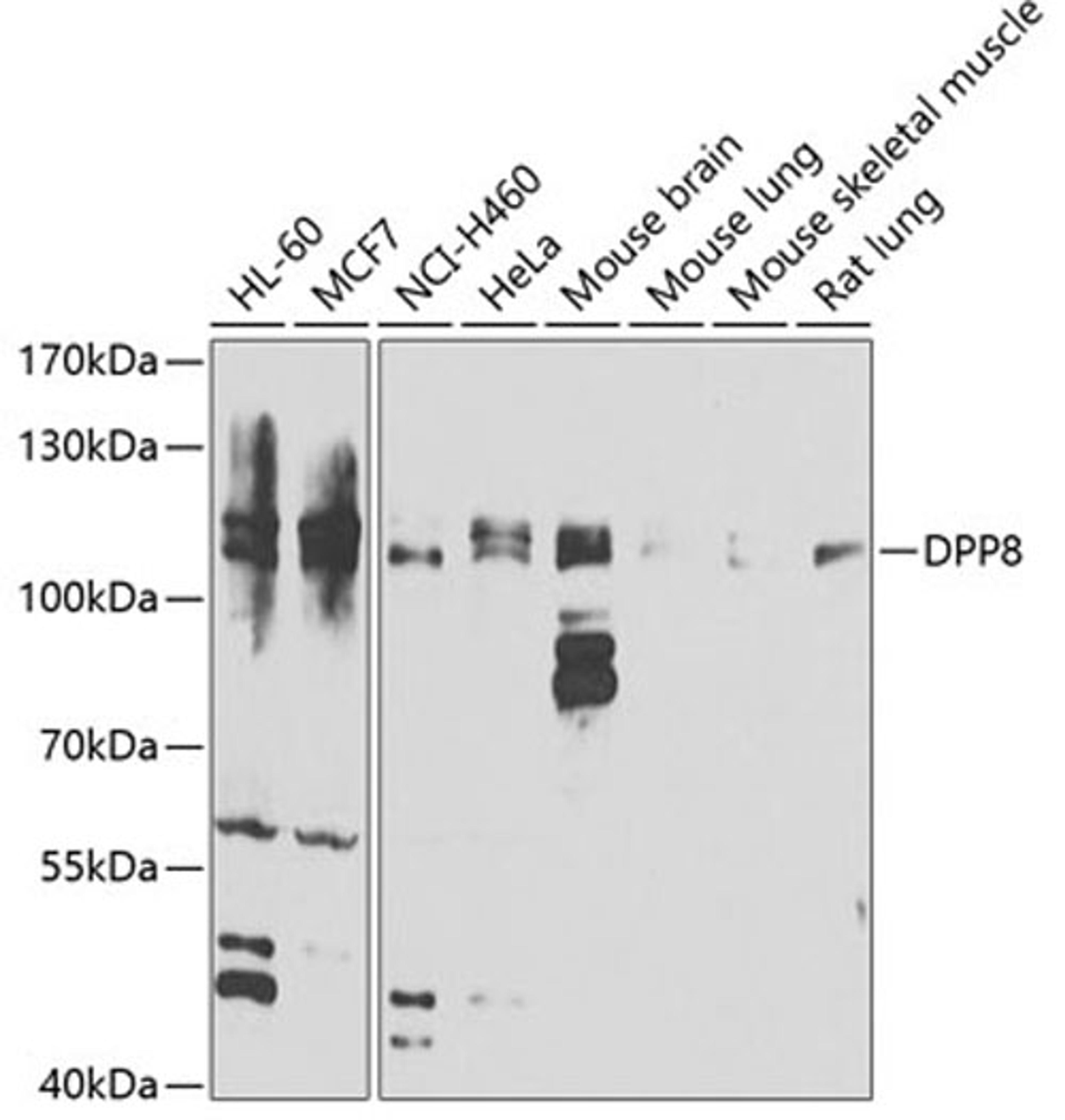 Western blot - DPP8 antibody (A7113)