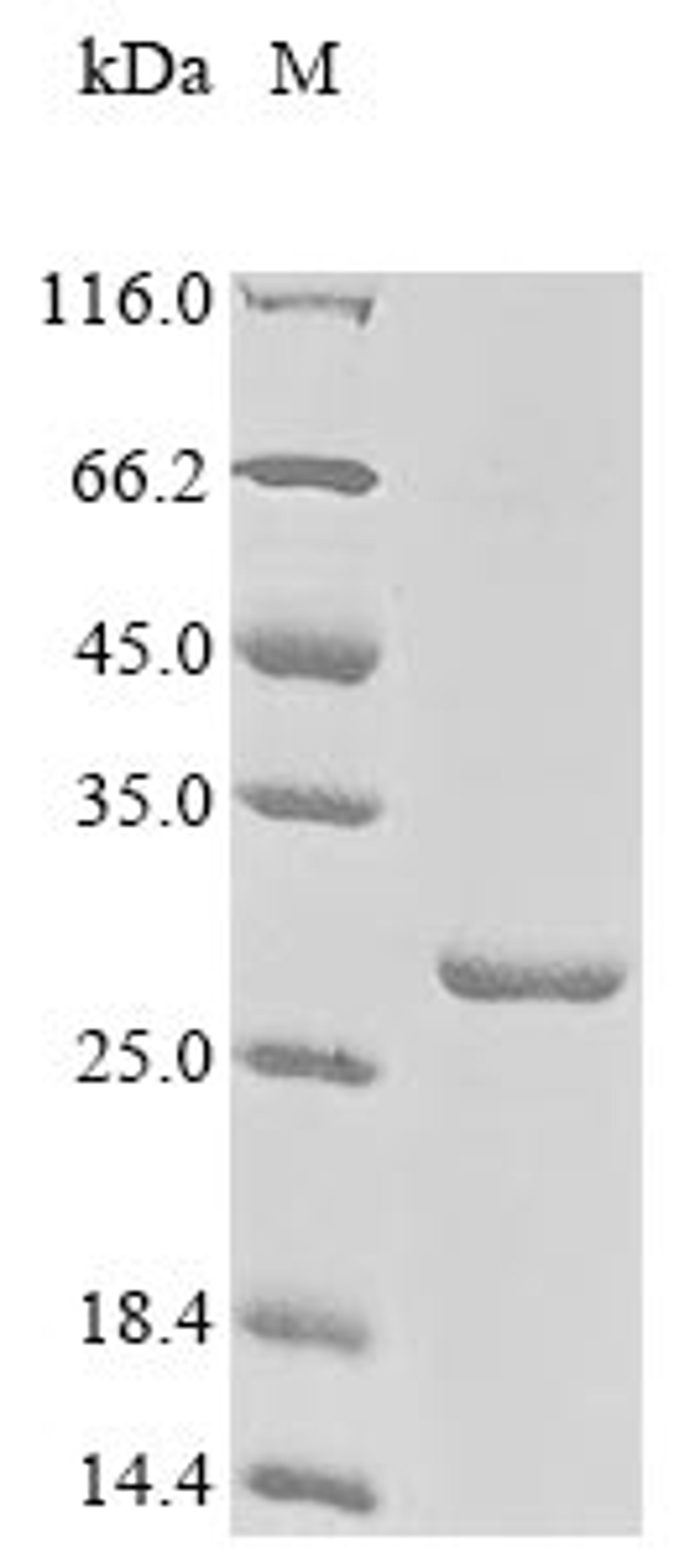 (Tris-Glycine gel) Discontinuous SDS-PAGE (reduced) with 5% enrichment gel and 15% separation gel.