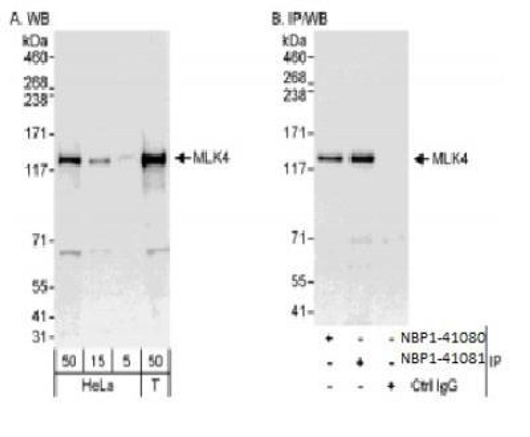 Western Blot: MLK4 Antibody [NBP1-41081] - Whole cell lysate from HeLa   (5, 15 and 50 ug for WB; 1 mg for IP, 20% of IP loaded) and 293T (T; 50 ug) cells. Antibodies: Affinity purified rabbit antiMLK4 antibody NBP1-41081 used for WB at 0.04 ug/ml (A) and 1 ug/ml (B) and used for IP at 3 ug/mg lysate.  MLK4 was also immunoprecipitated by rabbit anti-MLK4 antibody NBP1-41080, which recognizes an upstream epitope.