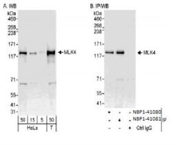 Western Blot: MLK4 Antibody [NBP1-41081] - Whole cell lysate from HeLa   (5, 15 and 50 ug for WB; 1 mg for IP, 20% of IP loaded) and 293T (T; 50 ug) cells. Antibodies: Affinity purified rabbit antiMLK4 antibody NBP1-41081 used for WB at 0.04 ug/ml (A) and 1 ug/ml (B) and used for IP at 3 ug/mg lysate.  MLK4 was also immunoprecipitated by rabbit anti-MLK4 antibody NBP1-41080, which recognizes an upstream epitope.