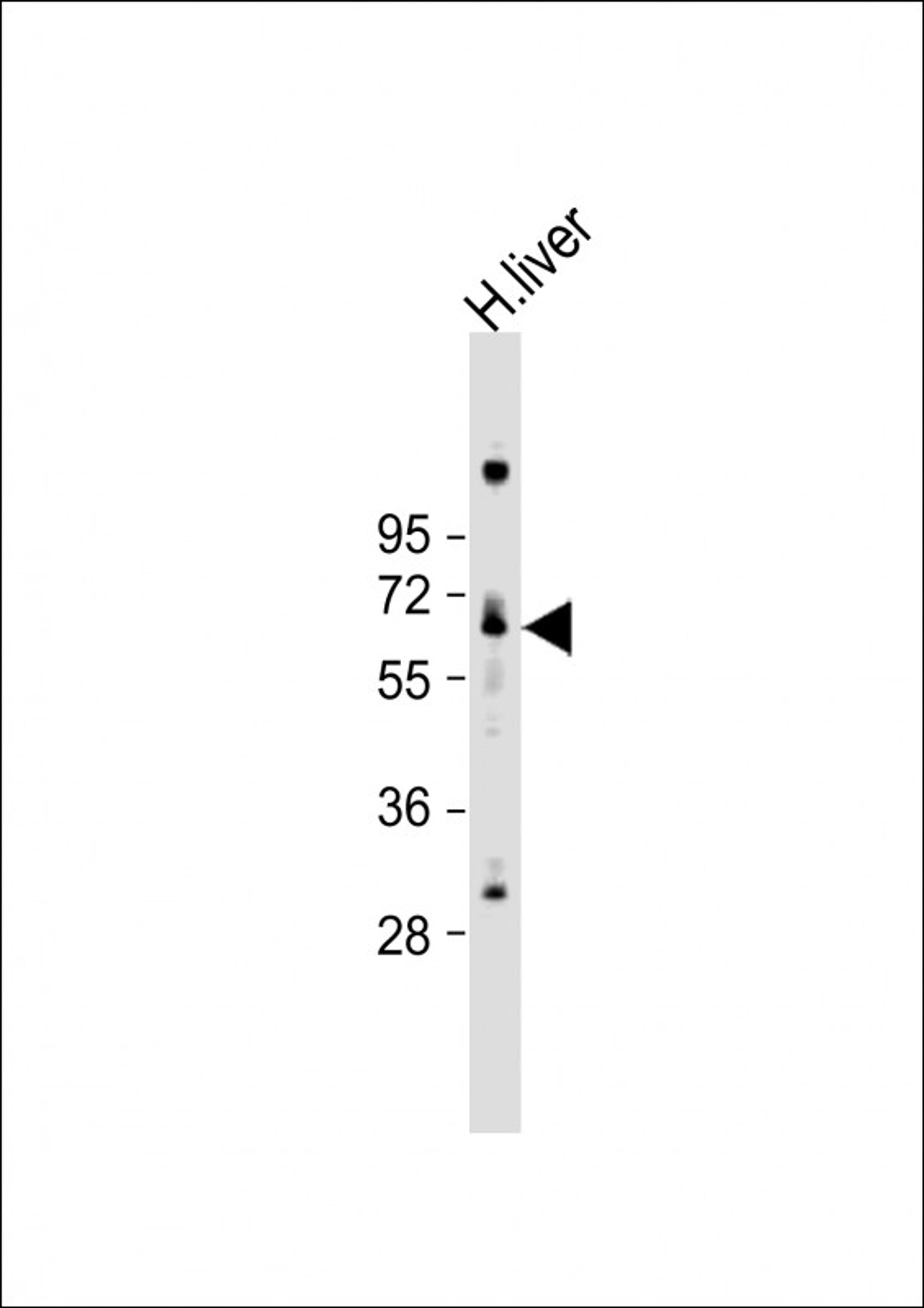 Western Blot at 1:1000 dilution + human liver lysate Lysates/proteins at 20 ug per lane.