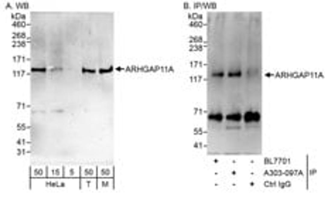 Detection of human and mouse ARHGAP11A by western blot (h & m) and immunoprecipitation (h).