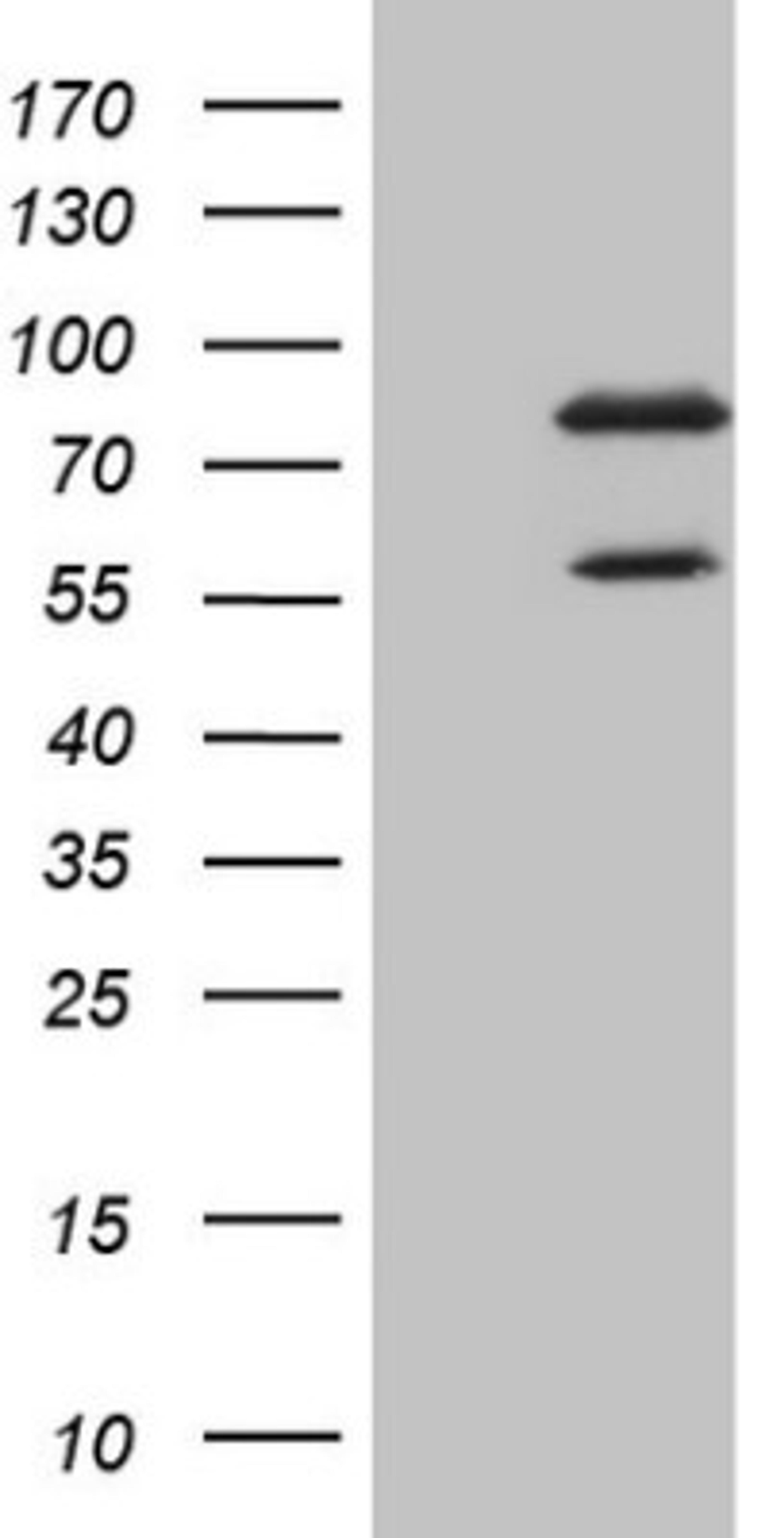 Western Blot: SCMH1 Antibody (5E6) [NBP2-45724] - Analysis of HEK293T cells were transfected with the pCMV6-ENTRY control (Left lane) or pCMV6-ENTRY SCMH1.