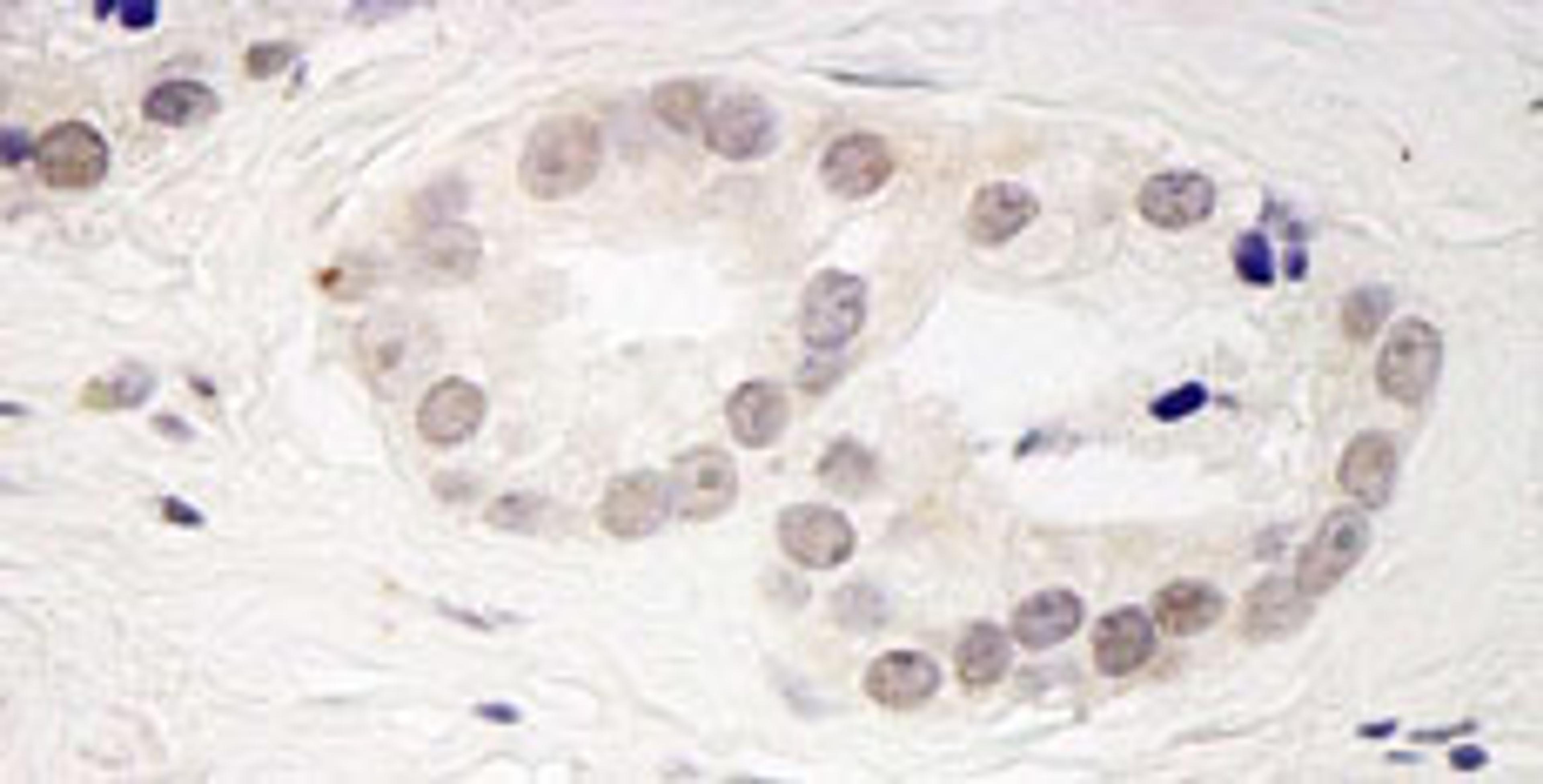 Detection of human PPP4R3 Beta by immunohistochemistry.