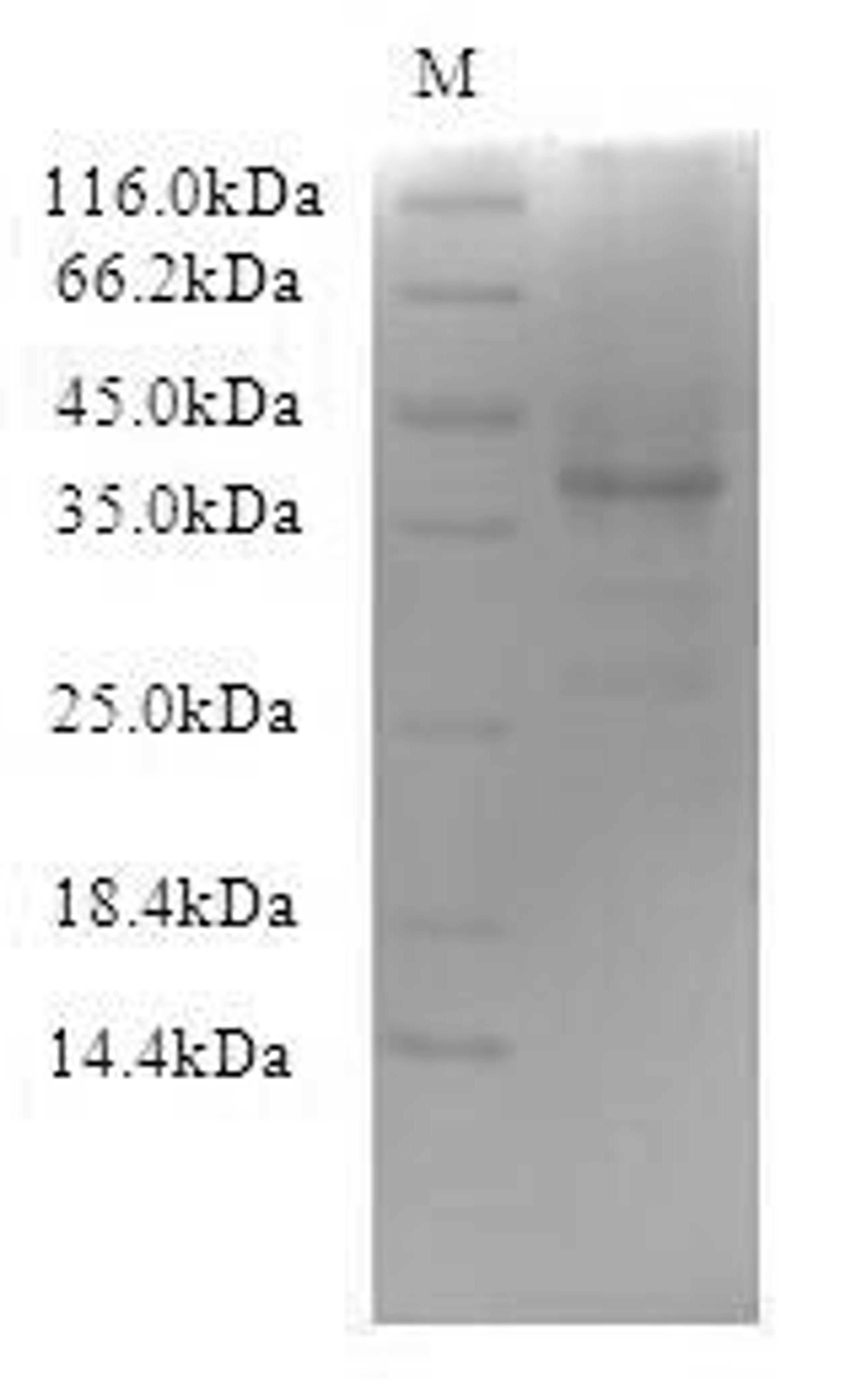 (Tris-Glycine gel) Discontinuous SDS-PAGE (reduced) with 5% enrichment gel and 15% separation gel.