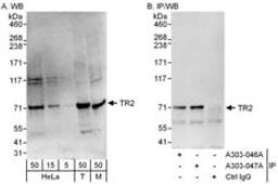 Detection of human and mouse TR2 by western blot (h&m) and immunoprecipitation (h).