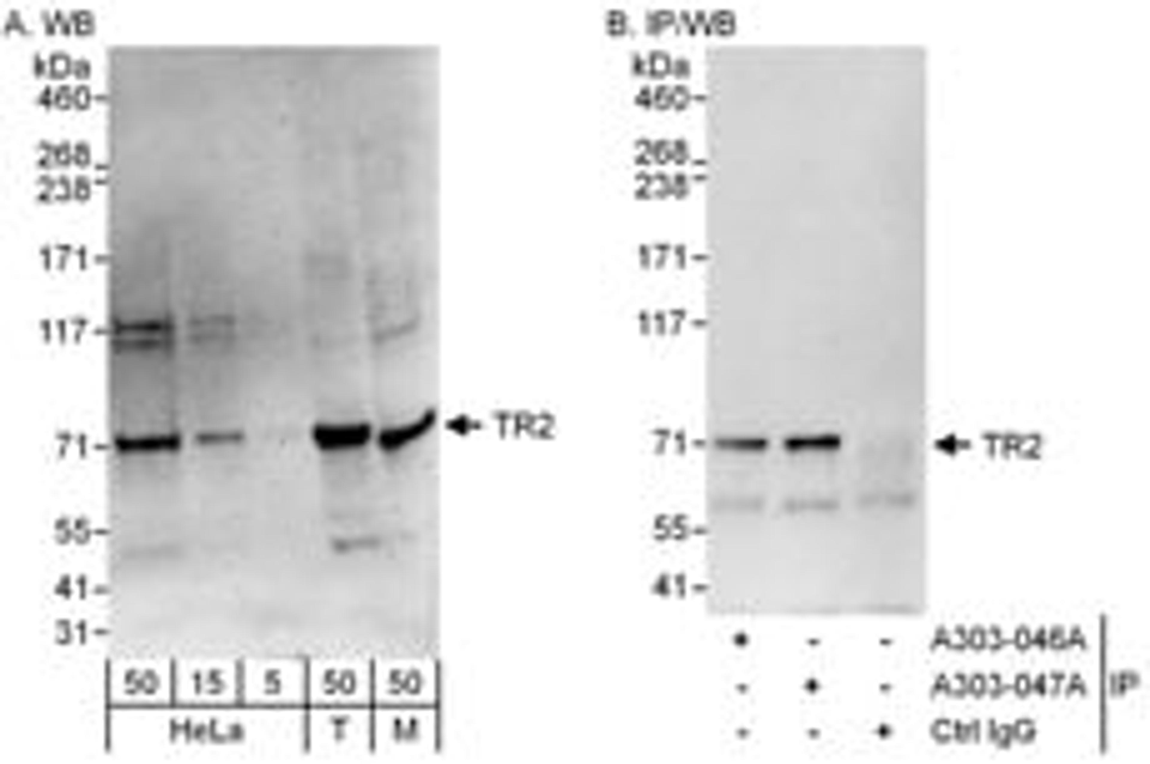 Detection of human and mouse TR2 by western blot (h&m) and immunoprecipitation (h).