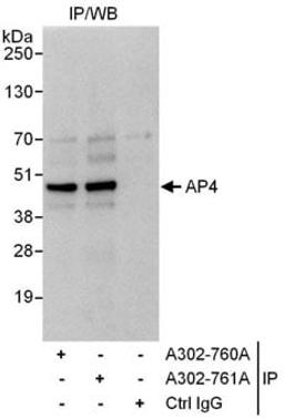 Detection of human AP4 by western blot of immunoprecipitates.