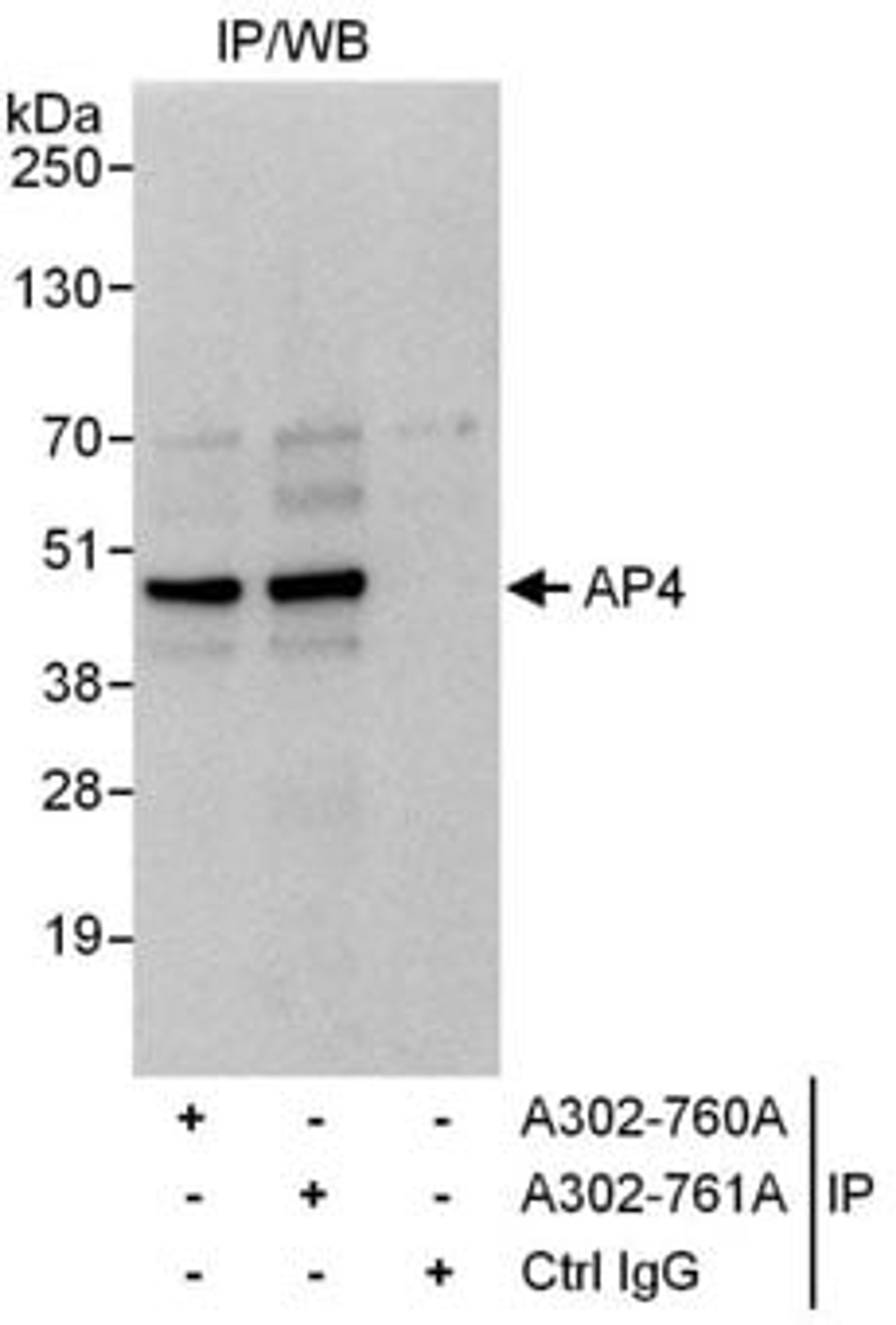 Detection of human AP4 by western blot of immunoprecipitates.