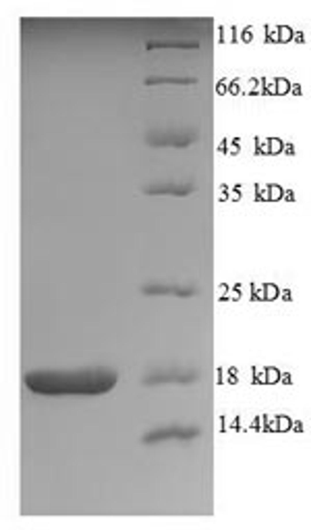 (Tris-Glycine gel) Discontinuous SDS-PAGE (reduced) with 5% enrichment gel and 15% separation gel.