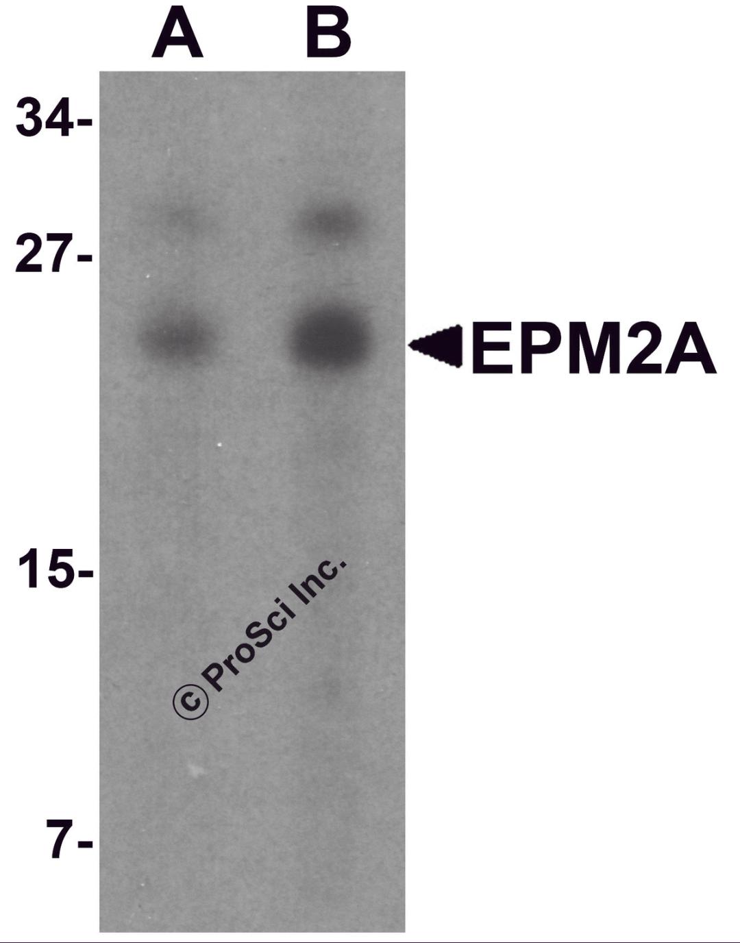 Western blot analysis of SW480 in SW480 cell lysate with EPM2A antibody at (A) 1 and (B) 2 μg/mL.