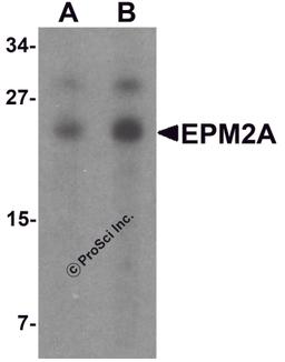 Western blot analysis of SW480 in SW480 cell lysate with EPM2A antibody at (A) 1 and (B) 2 μg/mL.