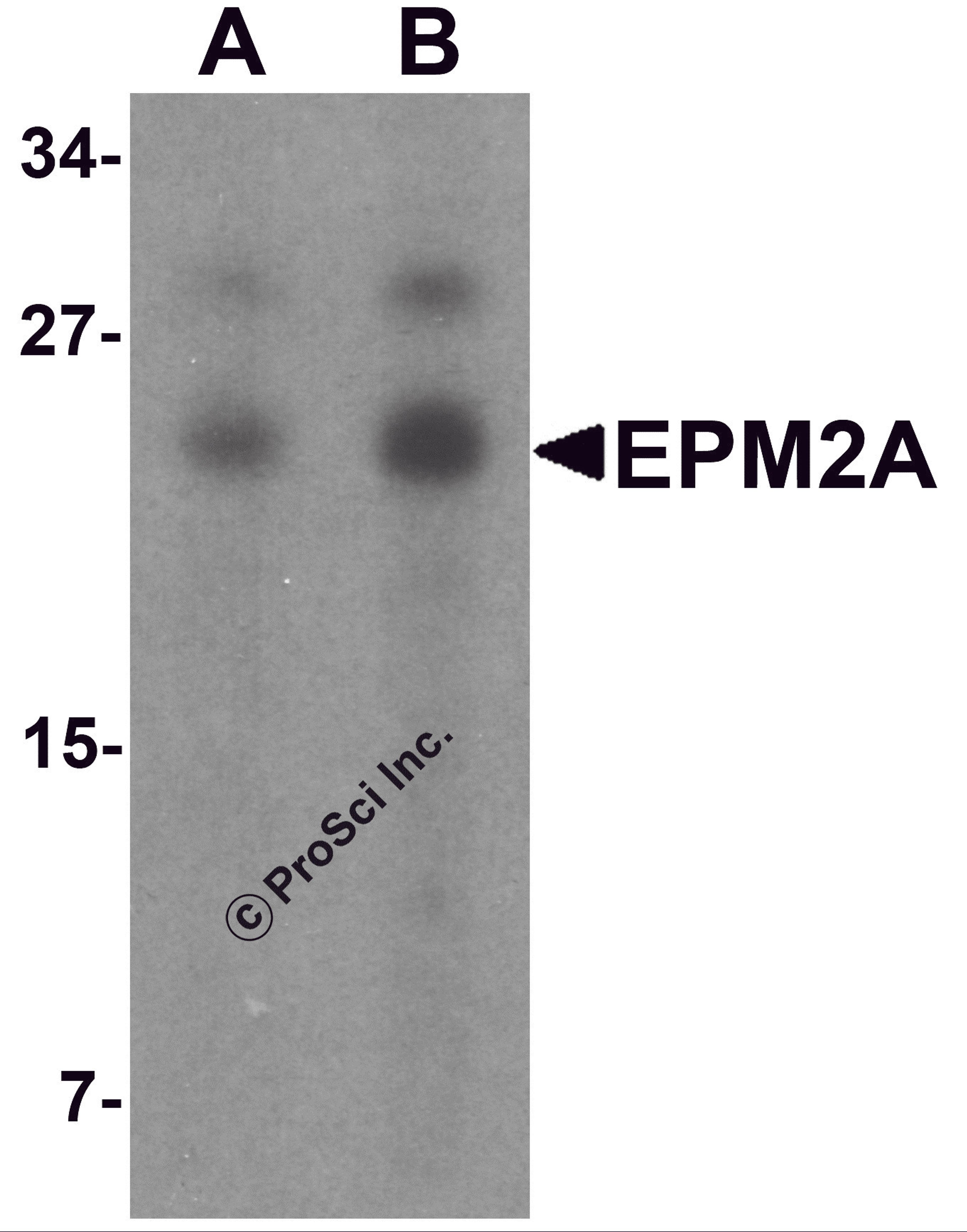 Western blot analysis of SW480 in SW480 cell lysate with EPM2A antibody at (A) 1 and (B) 2 μg/mL.