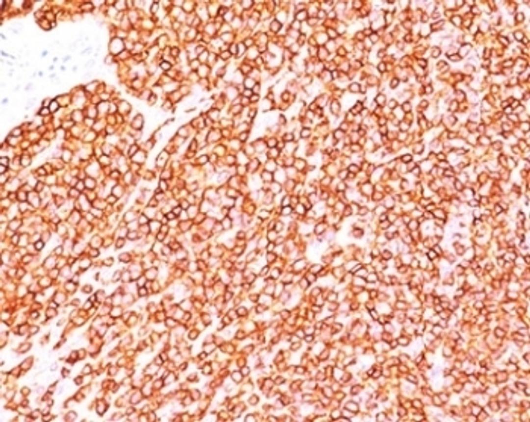 IHC testing of human tonsil stained with CD45RB antibody (BRA-11).