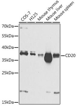 Western blot - CD20 Antibody (A1793)