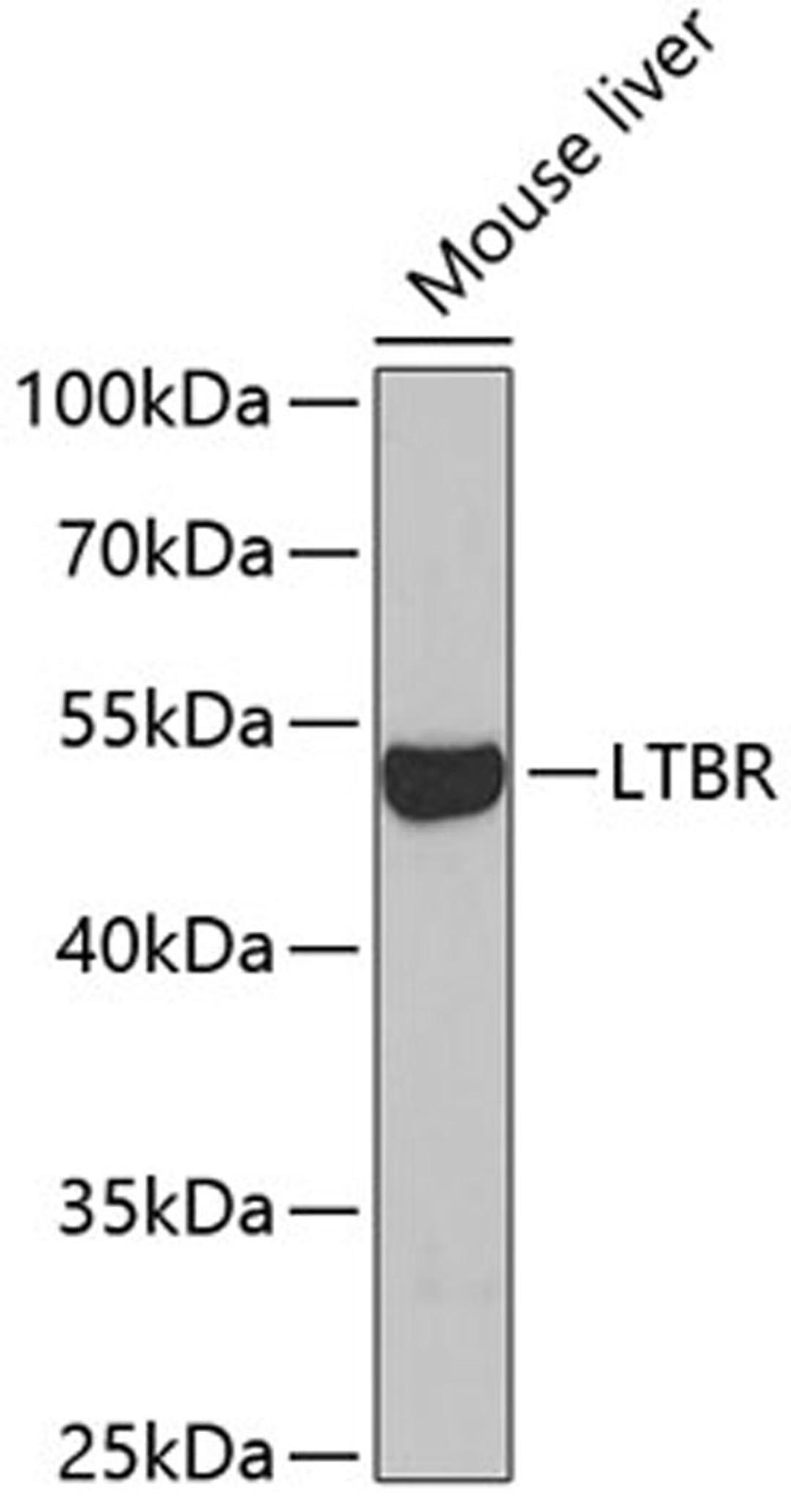 Western blot - LTBR antibody (A5351)