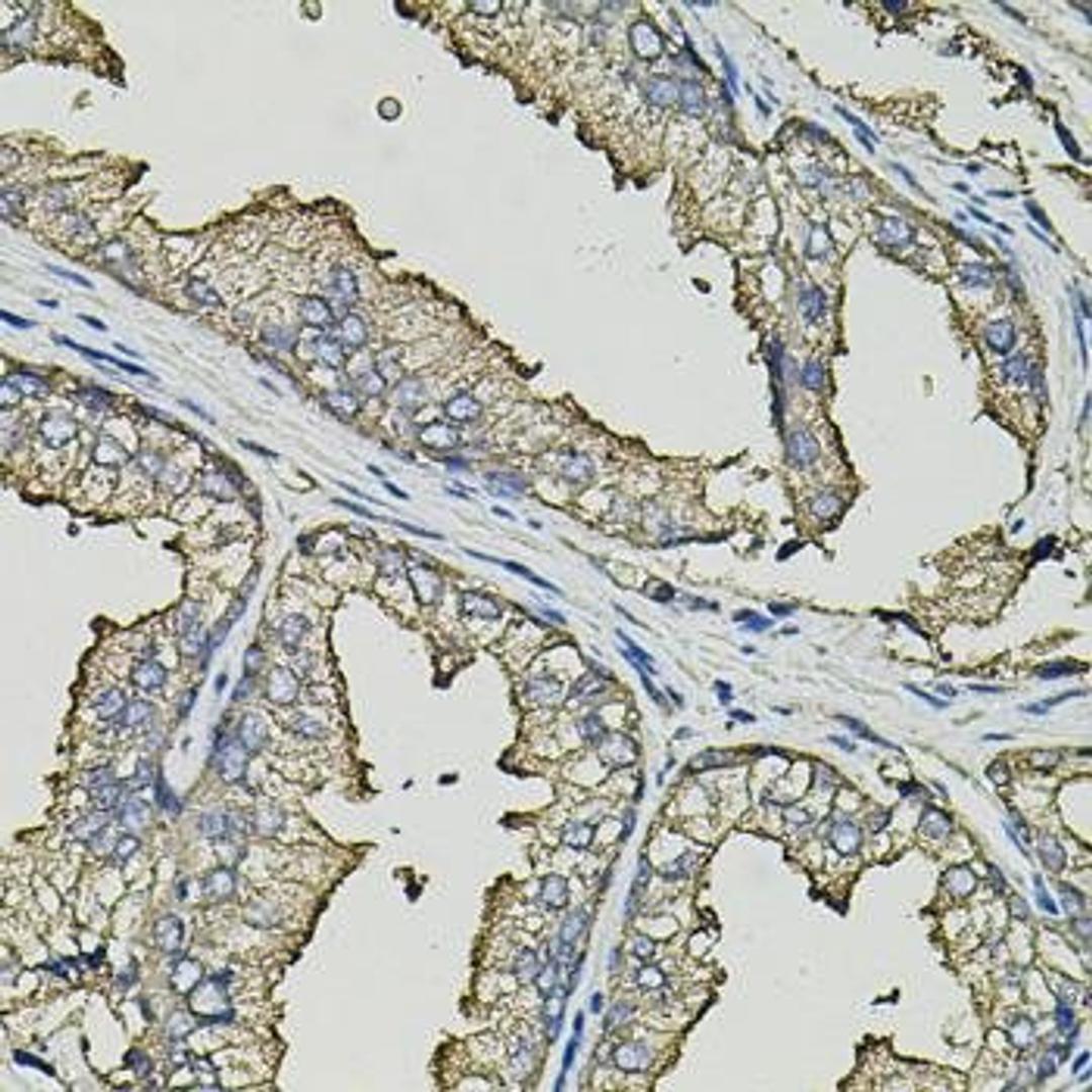 Immunohistochemical staining of human prostate tissue using SMN2 antibody