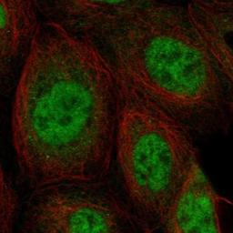 Immunocytochemistry/Immunofluorescence: SNRNP27 Antibody [NBP1-80808] - staining of human cell line A-431 shows positivity in nucleus but not nucleoli.