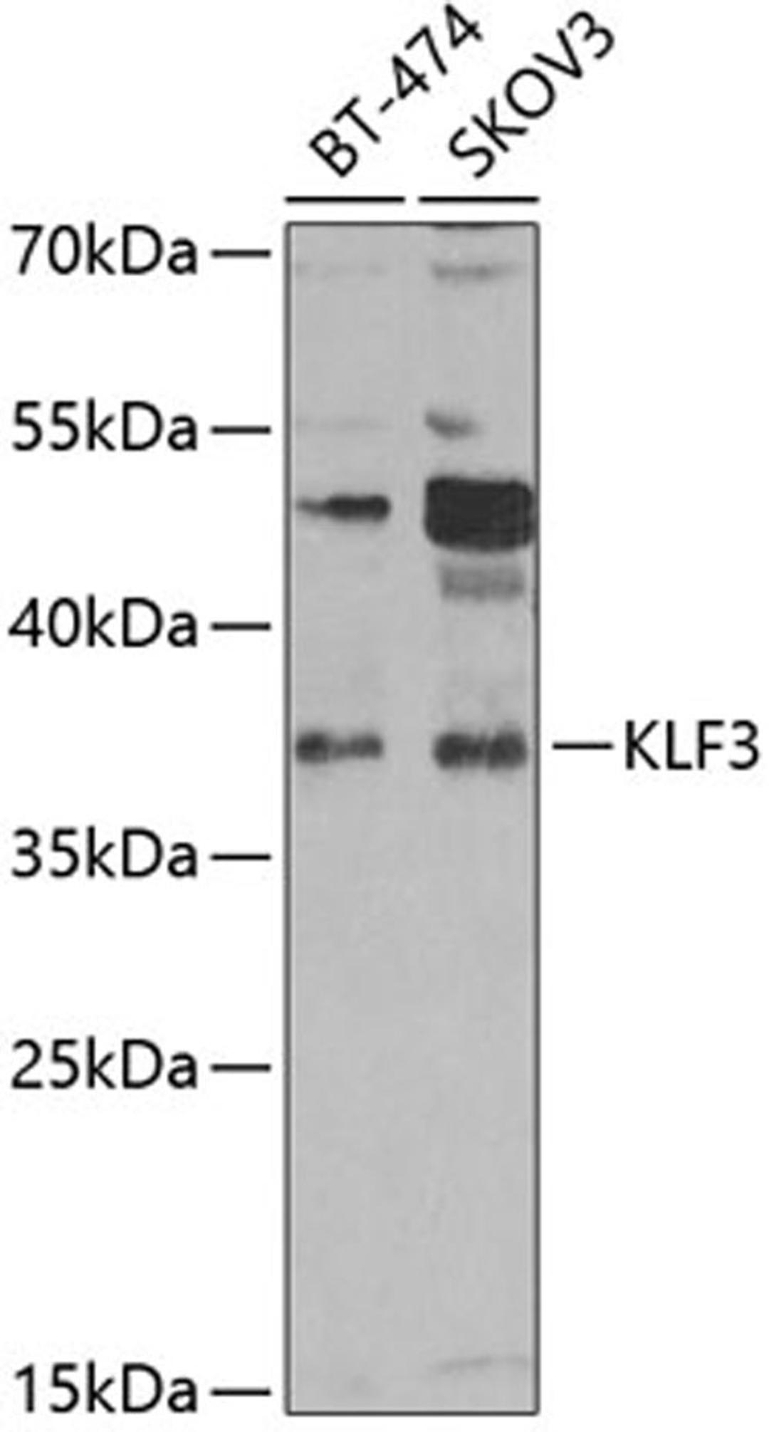 Western blot - KLF3 antibody (A7195)