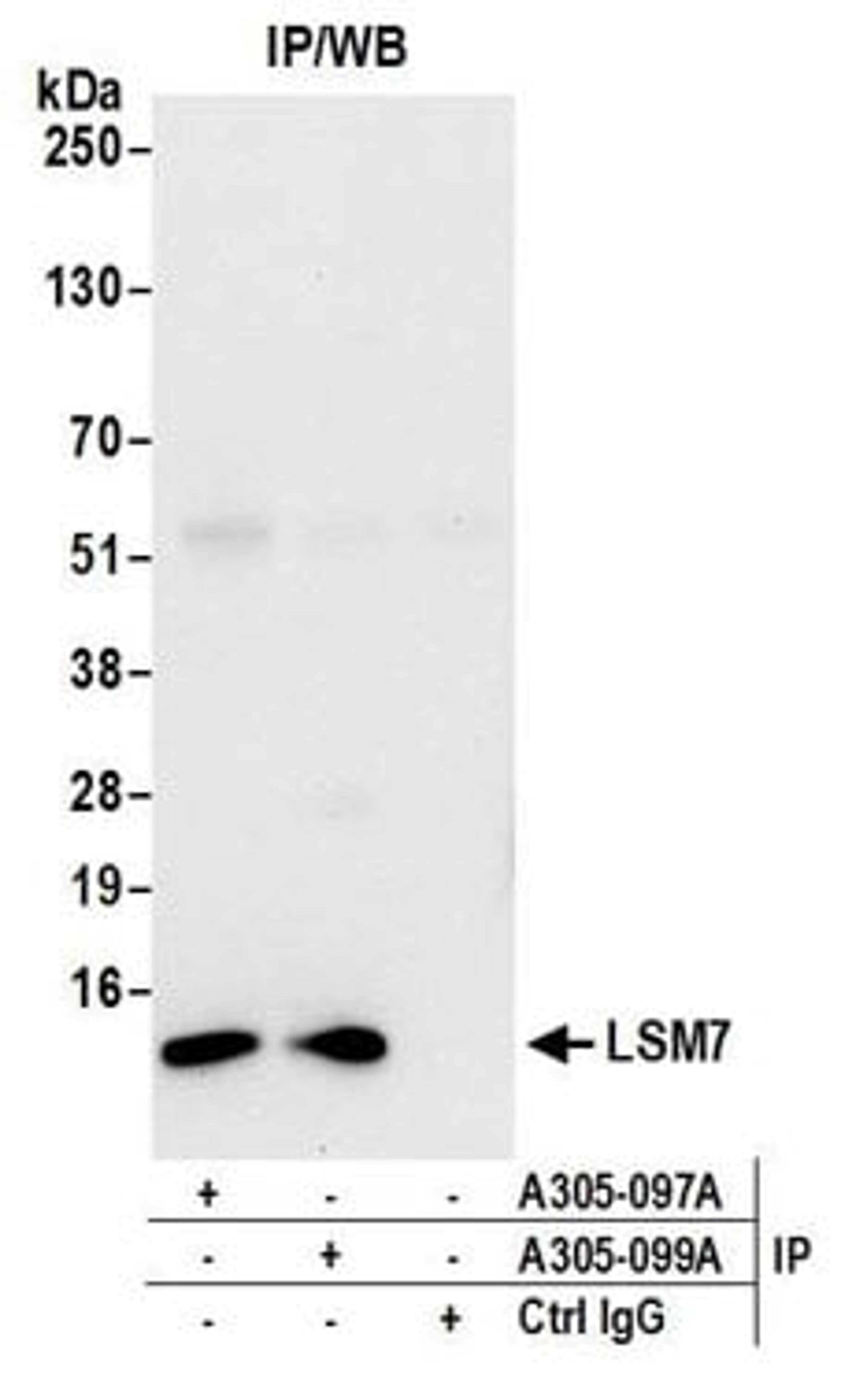 Detection of human LSM7 by western blot of immunoprecipitates.