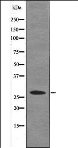 Western blot analysis of Insulin treated HT29 whole cell lysates using Caveolin 2 -Phospho-Ser36- antibody